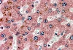 Anti-Apolipoprotein CI antibody, C-term used in IHC (Paraffin sections) (IHC-P). GTX89085