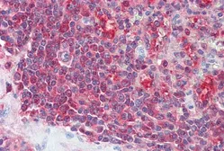 Anti-PSME2 antibody, C-term used in IHC (Paraffin sections) (IHC-P). GTX89096