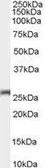 Anti-Connexin 26 antibody, C-term used in Western Blot (WB). GTX89128