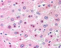 Anti-C14orf68 antibody, Internal used in IHC (Paraffin sections) (IHC-P). GTX89144