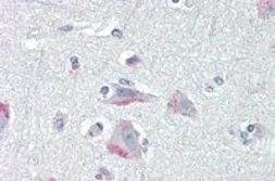 Anti-CRHR1 (aa 250 - 263) antibody, Internal used in IHC (Paraffin sections) (IHC-P). GTX89157