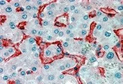 Anti-VAP1 antibody, Internal used in IHC (Paraffin sections) (IHC-P). GTX89161