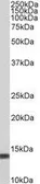 Anti-S100A4 antibody, C-term used in Western Blot (WB). GTX89197