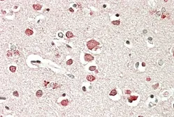 Anti-Neurobeachin antibody, C-term used in IHC (Paraffin sections) (IHC-P). GTX89207
