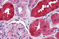 Anti-RNF213 antibody, Internal used in IHC (Paraffin sections) (IHC-P). GTX89208