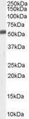 Anti-ZMPSTE24 antibody, C-term used in Western Blot (WB). GTX89219