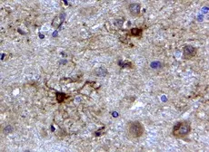 Anti-GFAP antibody, C-term used in IHC (Paraffin sections) (IHC-P). GTX89226