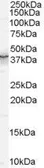 Anti-QKI antibody, N-term used in Western Blot (WB). GTX89271