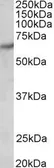 Anti-PAK1 antibody, Internal used in Western Blot (WB). GTX89274