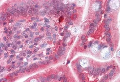Anti-COMT antibody, Internal used in IHC (Paraffin sections) (IHC-P). GTX89277