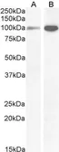 Anti-NMDAR1 antibody, Internal used in Western Blot (WB). GTX89302