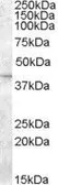 Anti-SLC24A5 antibody, Internal used in Western Blot (WB). GTX89312