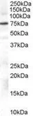 Anti-GRK2 antibody, Internal used in Western Blot (WB). GTX89353