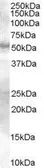 Anti-SMAD9 antibody, Internal used in Western Blot (WB). GTX89360