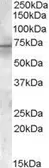 Anti-Pyruvate dehydrogenase kinase 1 / PDK1 antibody, Internal used in Western Blot (WB). GTX89378