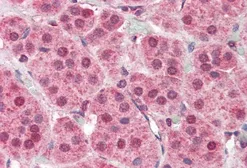 Anti-PARP2 antibody, Internal used in IHC (Paraffin sections) (IHC-P). GTX89417