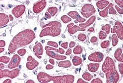 Anti-PDE4D antibody, C-term used in IHC (Paraffin sections) (IHC-P). GTX89423
