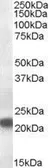 Anti-VPS25 antibody, Internal used in Western Blot (WB). GTX89428