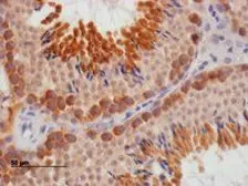 Anti-DAZL antibody, Internal used in IHC (Paraffin sections) (IHC-P). GTX89448