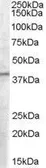 Anti-PCID1 antibody, C-term used in Western Blot (WB). GTX89456