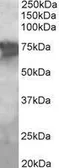 Anti-PCK2 antibody, Internal used in Western Blot (WB). GTX89464
