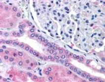 Anti-Rhophilin 2 antibody, Internal used in IHC (Paraffin sections) (IHC-P). GTX89485