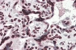 Anti-HMGA1 antibody, Internal used in IHC (Paraffin sections) (IHC-P). GTX89486