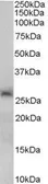 Anti-SIRT3 antibody, C-term used in Western Blot (WB). GTX89507