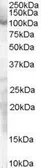 Anti-SP1 antibody, Internal used in Western Blot (WB). GTX89511