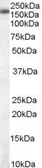 Anti-SART3 antibody, C-term used in Western Blot (WB). GTX89518