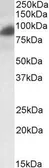 Anti-RAB11FIP1 antibody, Internal used in Western Blot (WB). GTX89523