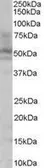 Anti-HNF4 alpha antibody, N-term used in Western Blot (WB). GTX89532