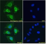 Anti-Asporin antibody, Internal used in Immunocytochemistry/ Immunofluorescence (ICC/IF). GTX89589