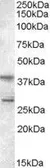 Anti-SCAP2 antibody, C-term used in Western Blot (WB). GTX89599