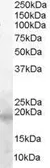 Anti-Survivin antibody, C-term used in Western Blot (WB). GTX89625