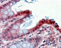 Anti-15-PGDH antibody, C-term used in IHC (Paraffin sections) (IHC-P). GTX89634