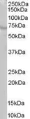 Anti-RIC8A antibody, C-term used in Western Blot (WB). GTX89648