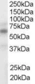 Anti-LXR alpha / LXR beta antibody, Internal used in Western Blot (WB). GTX89656