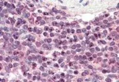 Anti-LXR beta antibody, N-term used in IHC (Paraffin sections) (IHC-P). GTX89661