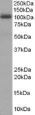 Anti-AKAP8 antibody, N-term used in Western Blot (WB). GTX89667