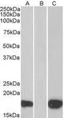 Anti-PHLDA3 antibody, C-term used in Western Blot (WB). GTX89684