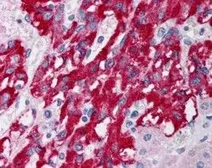 Anti-DLC1 (Isoforms 1 and 3) antibody, N-term used in IHC (Paraffin sections) (IHC-P). GTX89689