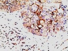 Anti-EPS8 antibody, C-term used in IHC (Paraffin sections) (IHC-P). GTX89748