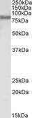 Anti-FACL4 antibody, C-term used in Western Blot (WB). GTX89766