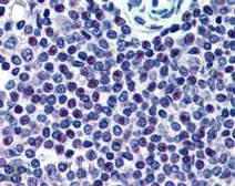 Anti-HMG20A antibody, C-term used in IHC (Paraffin sections) (IHC-P). GTX89778