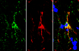 Anti-Iba1 (isoform 1 and 3) antibody, C-term used in IHC (Frozen sections) (IHC-Fr). GTX89792