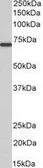 Anti-MTM1 antibody, C-term used in Western Blot (WB). GTX89799