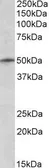 Anti-TRIM35 antibody, N-term used in Western Blot (WB). GTX89803