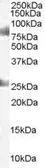 Anti-CDYL antibody, C-term used in Western Blot (WB). GTX89858