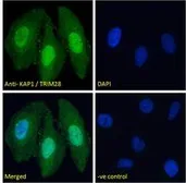 Anti-KAP1 antibody, C-term used in Immunocytochemistry/ Immunofluorescence (ICC/IF). GTX89879